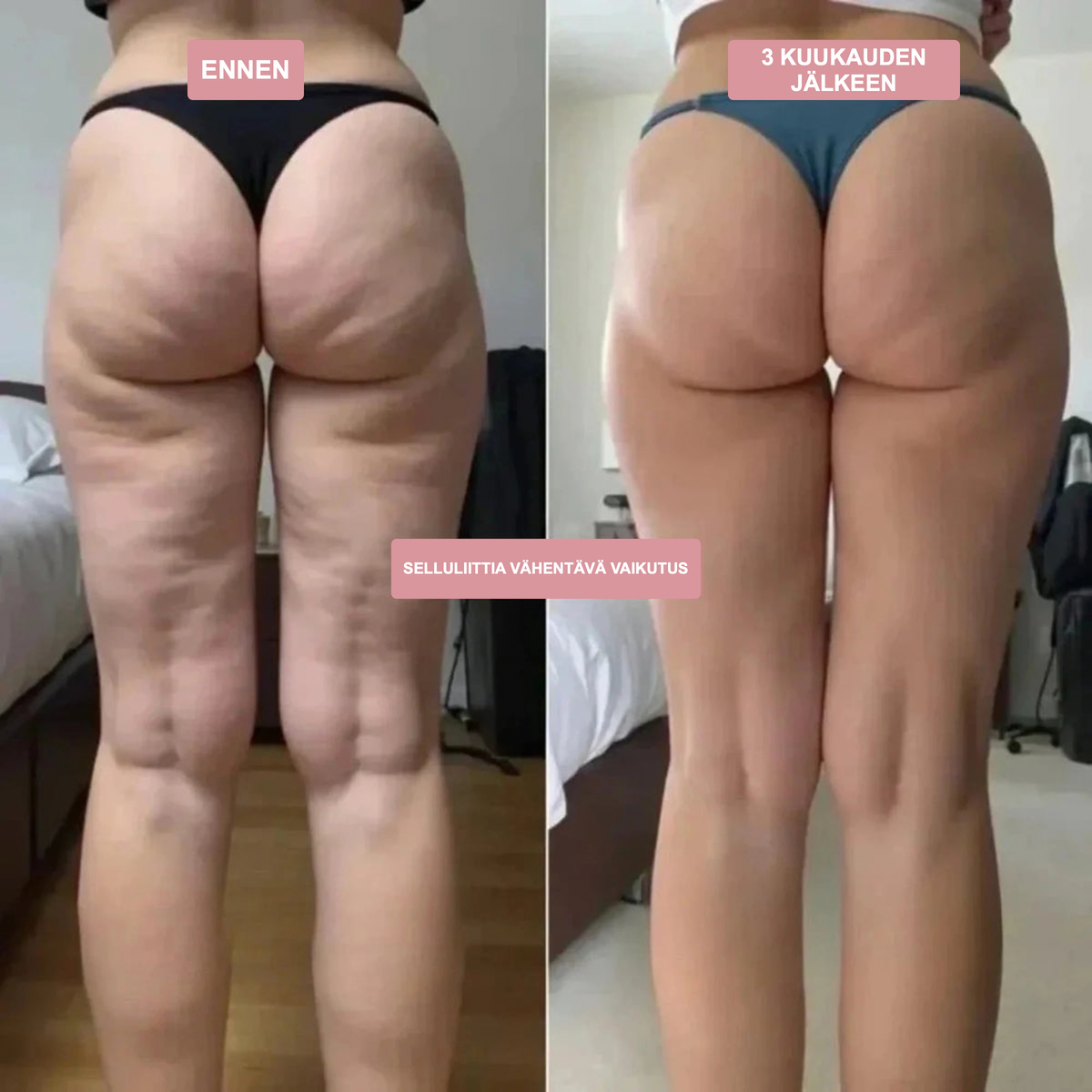 Legginsit 3D – Muotoilee & Silottaa
