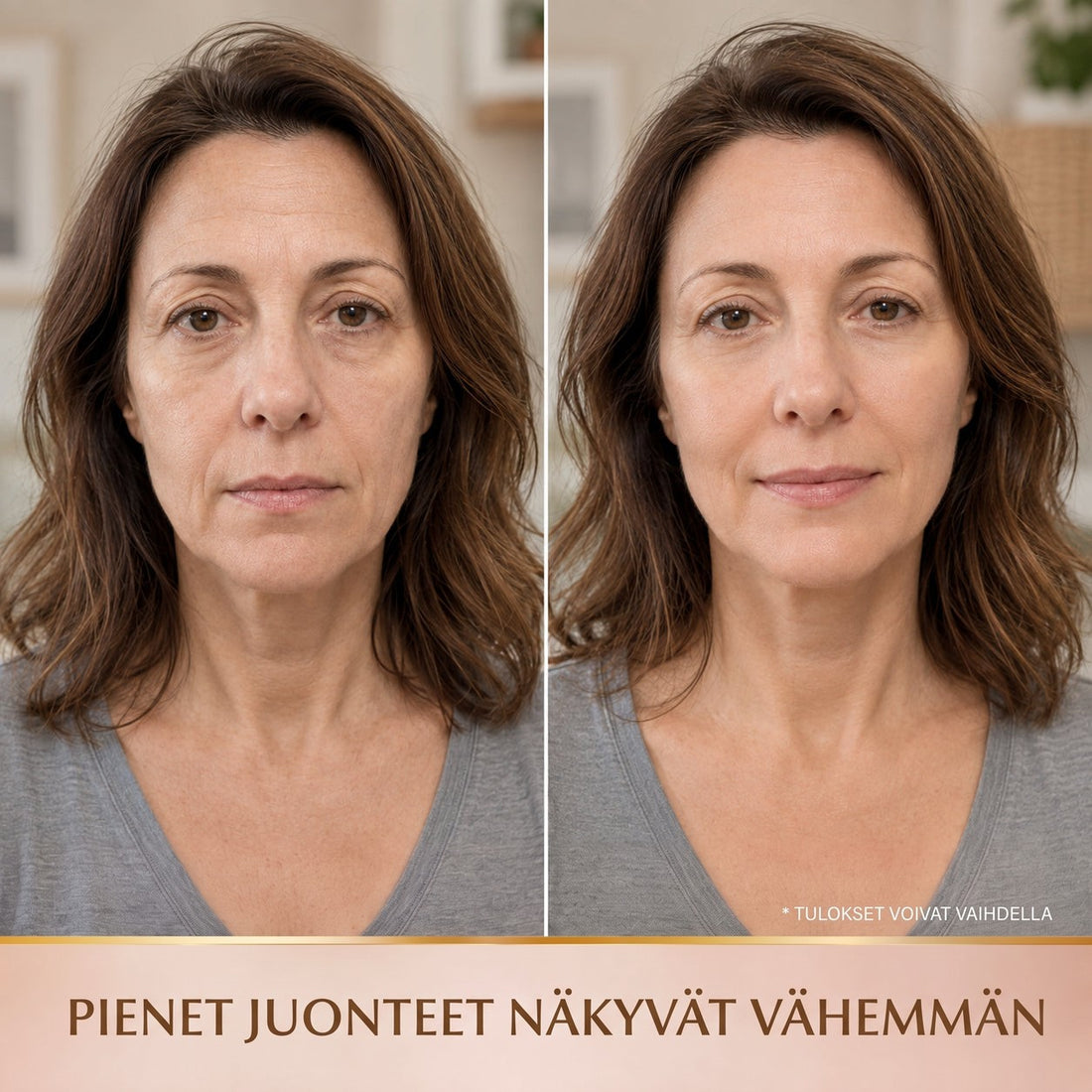 Ennen ja jälkeen – pienet juonteet näkyvät vähemmän