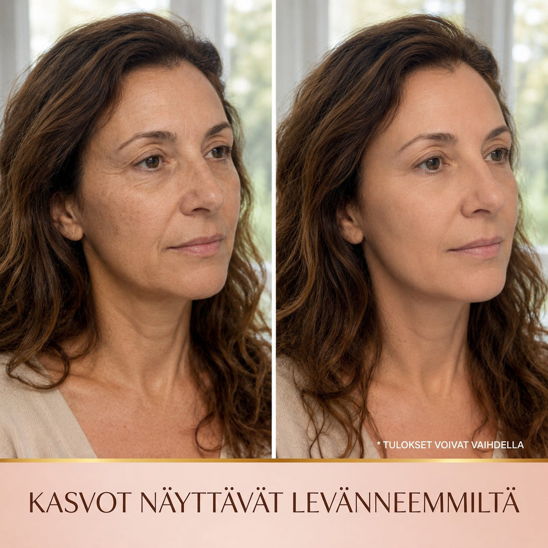 Ennen ja jälkeen – kasvot näyttävät levänneemmiltä